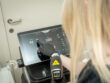 Consultatie voor laserontharing bij huidexpert