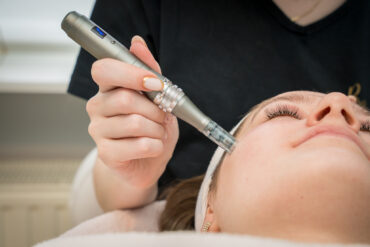 Wat Mag Je Wel en Niet Doen Na een Chemische Peeling?