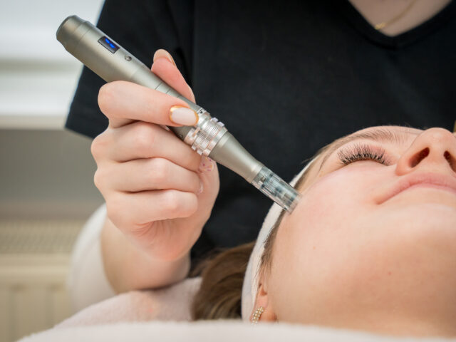 Microneedling behandeling met dermapen