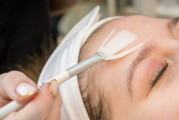 Laserontharing bij Gevoelige Huidzones: Tips en Advies