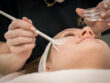 Voorbereiding chemische peeling