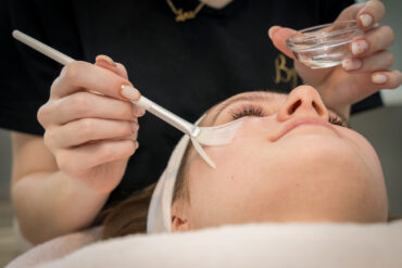 Voor en Na: Wat Mag Je Verwachten van Laserontharing met Diode Laser?