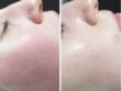 Vrouw met glanzende huid na peeling