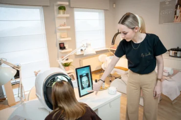 Pigmentvlekken Behandelen: Hoe Werkt een Chemische Peeling?