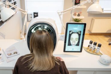 Is een Chemische Peeling Veilig voor de Gevoelige Huid?